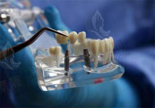 这么靠谱的牙科，怎么预约挂号更方便？看这?