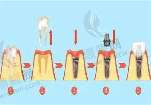 成都华圣艺口腔
