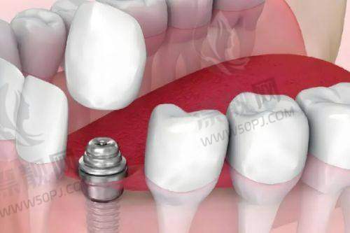 圣禾口腔擅长看哪些项目？一张表格让你看明白