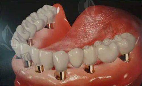 北京市口腔更好的医院怎么选?