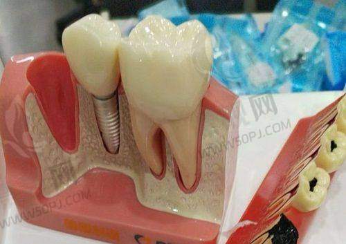 乐清齿逸口腔简介大揭秘:口碑好、实力强,种植牙、矫正等项目价格别错过!