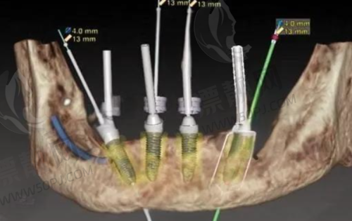 牙博士口腔(新都门诊)
