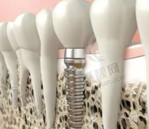 纠结成都新都区看牙哪家好?各口腔医院优势项目、价格特点全梳理!