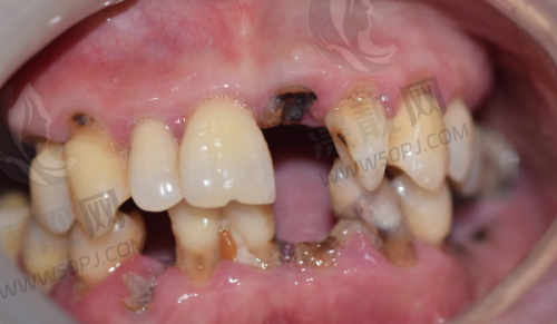 朝阳区推荐医院:北京佳美口腔(多点布局)