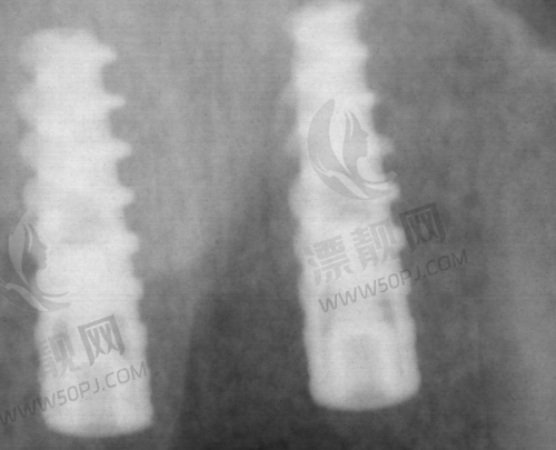 写在末尾:看牙别纠结,看清症状、对症选择