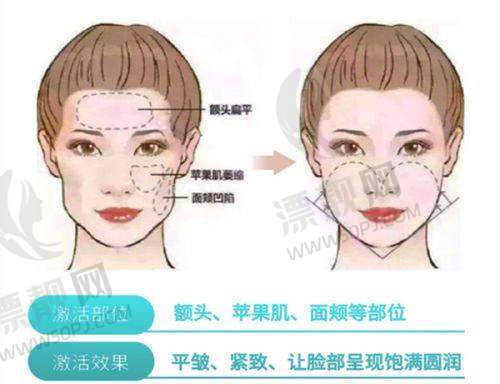 上海华美医疗美容医院:鼻修复平台实力选手,高难度整形做得稳