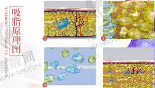 真人实例:北京嘉禾整形变得更美故事,侯智慧院长杰作