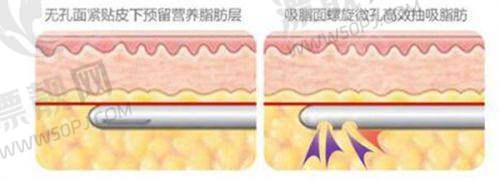 上海愉悦美联臣医疗美容医院：高端变得更美“新选择”