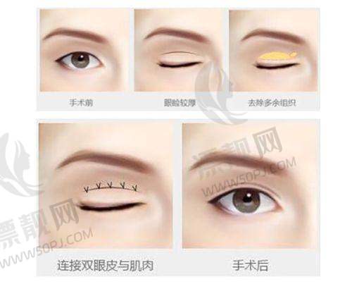 上海薇琳医疗美容医院:高端INS风医美馆,高颜环境出片地