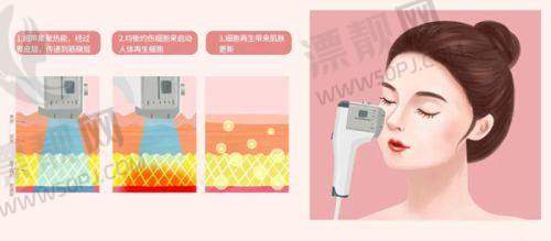 优势爆棚:北京嘉禾整形特色项目,侯智慧院长技术秀