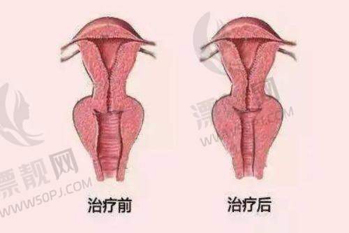 北京画美医疗美容——热门整形项目集合