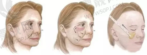 上海百达丽医疗美容门诊部：个性化变得更美“定制师”