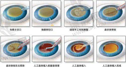 上海诺诗雅医疗美容诊所:轻医美标杆,护肤级小调调