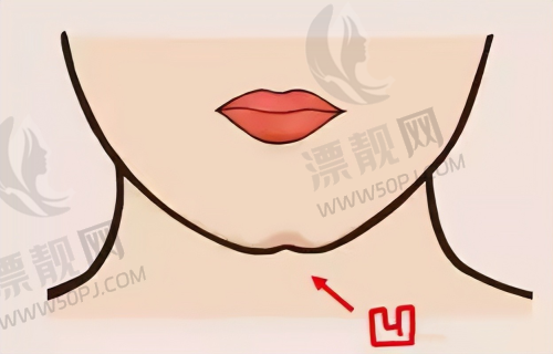 北京京韩医疗美容——吸脂项目突出