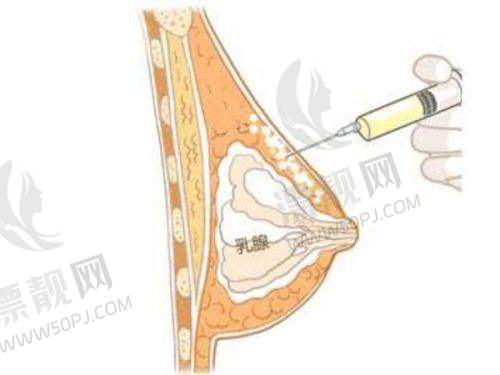 上海伊莱美医疗美容医院——综合实力强劲