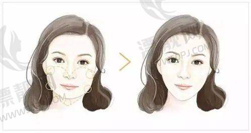 上海天大医疗美容医院:个性化定制,成效显著