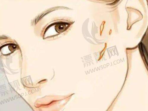 上海愉悦美联臣医疗美容：个性化定制的“变得更美骨干医生”