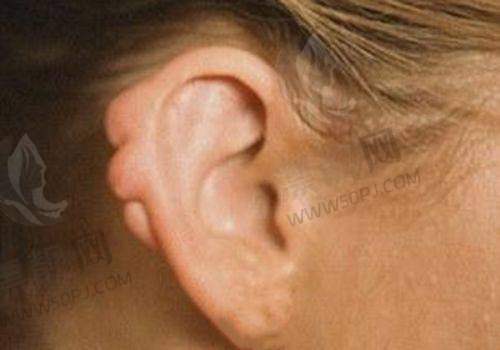 北京嘉禾整形的价格全解析:值不值得掏腰包?