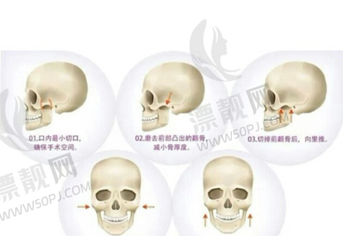 北京嘉禾整形王牌项目与价格大公开