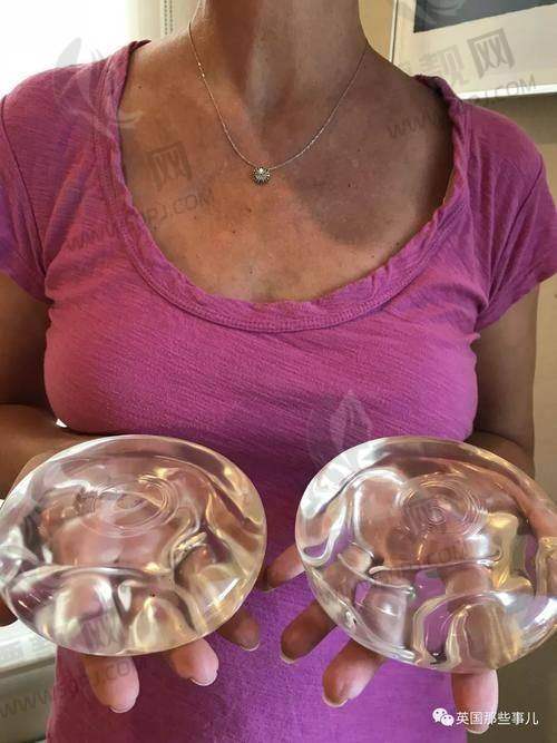 傲诺拉假体隆胸价格参考