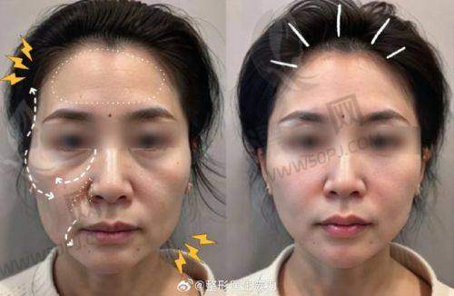 四、蒋铮铮医生的人气不是瞎火,口碑评价真·稳如老坛酸菜