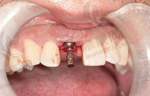 昌平区:牙适乐口腔