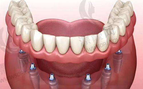 石景山区代表:北京首附一口腔医院