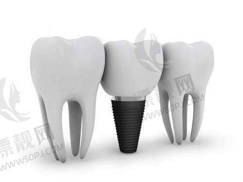 通州区诚意代表:雅仕口腔