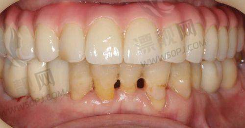 结语:选牙科不是难题,靠谱+合适才是关键