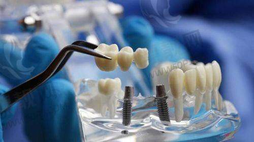 丰台区种植/儿童牙科代表:中诺口腔