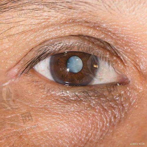 8. 西夏区人民医院眼科