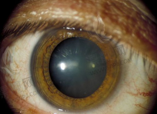 4. 银川开明眼科医院