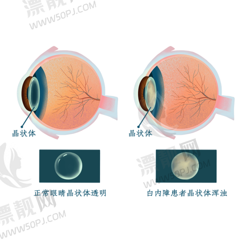 7. 灵武市人民医院眼科