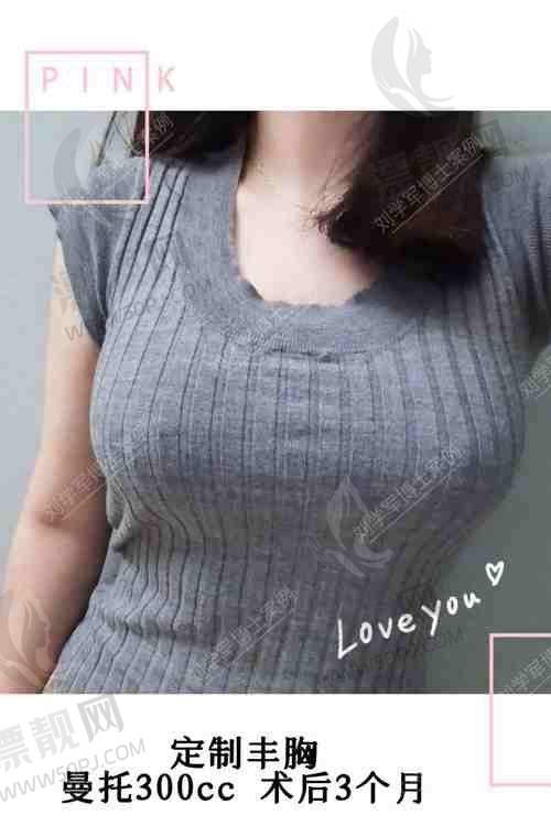 傲诺拉假体隆胸真伪辨别方法