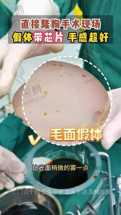 术后多久变软?40天手感揭秘来了!