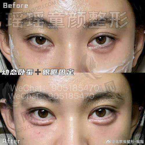 为什么选择北京嘉禾整形?优势大盘点