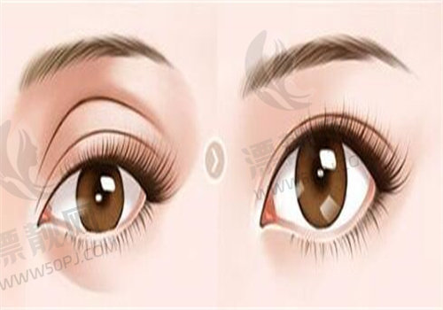 福州海峡医疗美容医院怎么样?硬核资质、技术强,鼻修复案例见证实力!