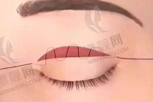 上海伊莱美医疗美容医院:综合实力强