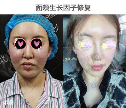 上海艺星整形:10月周年庆,项目优惠多