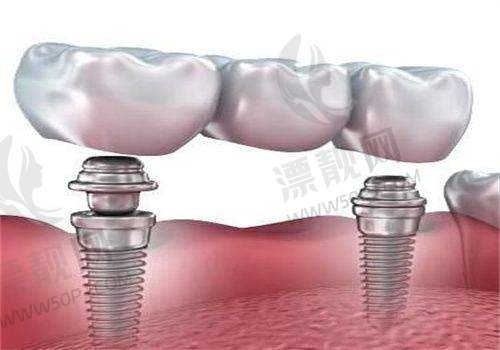六、结尾总结一下:看牙不再那么难,北京中诺口腔是真的懂你!