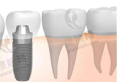 五、与济南其他主流口腔机构对比，一表搞清楚：