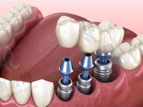 种牙选国有还是民营?这里告诉你答案