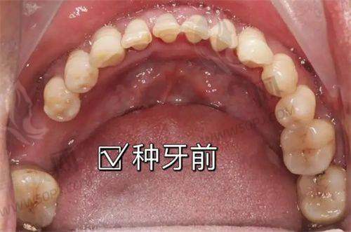 02 陕西中 医 药大学附属医院口腔科——细致入微的治疗体验