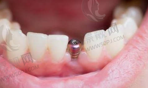 三、不迷路不踩坑——更实用地铁+公交路线指南