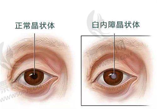 10. 上海爱尔眼科（浦东院区）——成熟品牌，多维度眼科服务网络