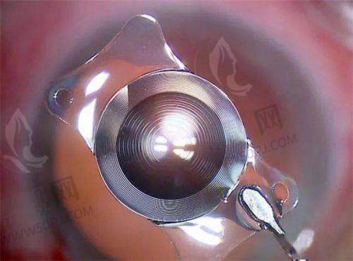 上海愉悦美联臣医疗美容医院:品牌影响力大