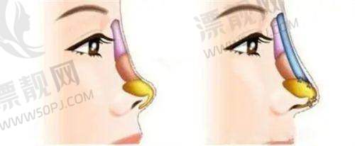 上海九院整复外科:老牌医院,实力雄厚