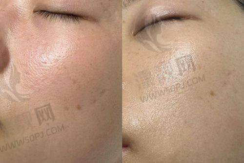 二、福州海峡医疗美容医院项目价格明细爆料：价格透明，没有“麻醉加价”吓你的套路