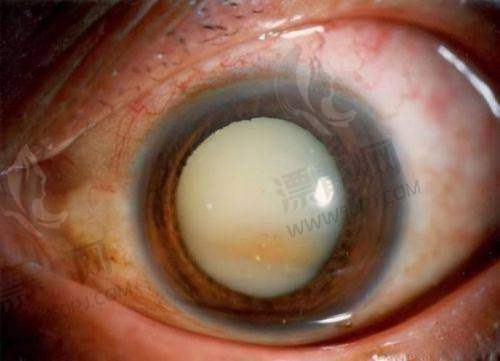 2. 上海未来视界眼科——连锁覆盖，区域服务好评不断