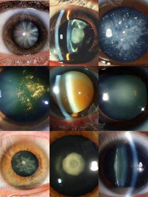 3. 上海瑞东医院眼科——视网膜与老年眼病管理的好帮手